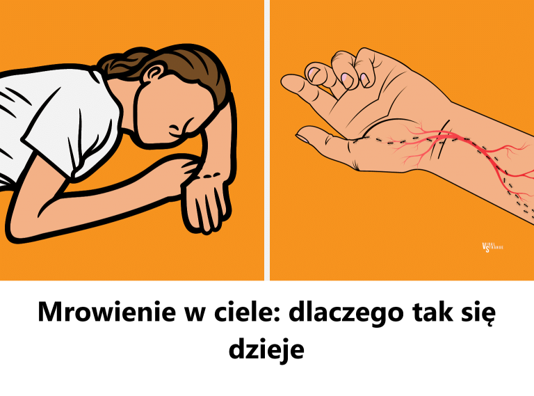 Mrowienie w ciele: dlaczego tak się dzieje