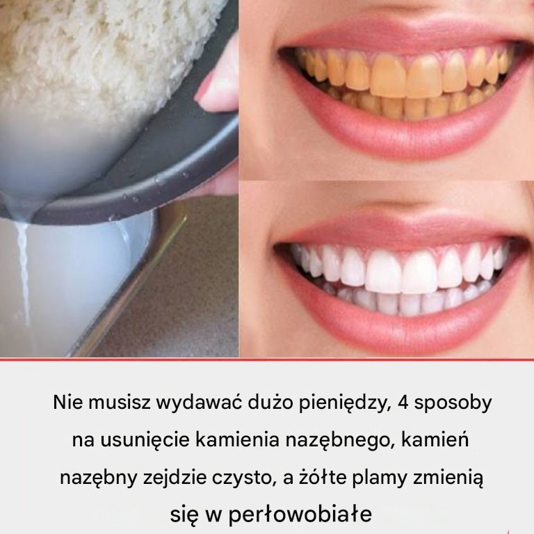 Nie marnuj więcej pieniędzy na dentystę.